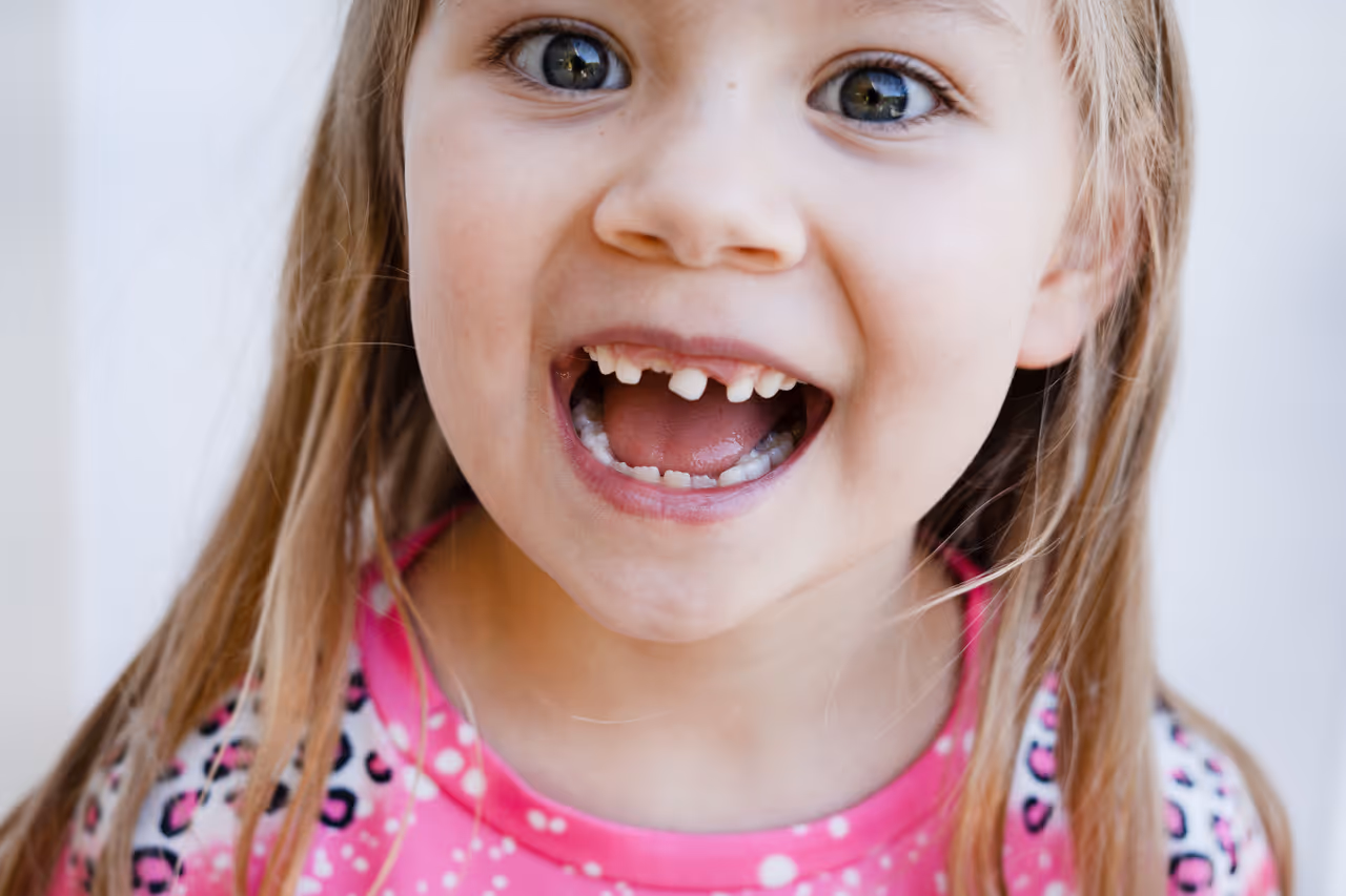 10 Things Every Parent Should Know About Baby Teeth Loss
